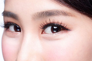 全切双眼皮：副作用与失败风险探讨