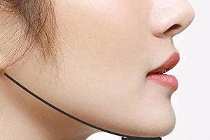 下颌角整形手术会导致下垂吗？及注意事项